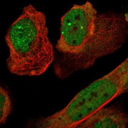 p57 Kip2 Antibody, Novus Biologicals 0.1mL; Unlabeled:Antibodies, Polyclonal