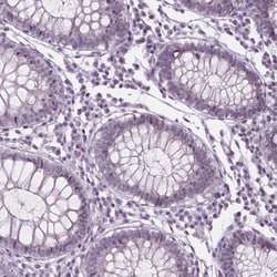 p57 Kip2 Antibody, Novus Biologicals 0.1mL; Unlabeled:Antibodies, Polyclonal