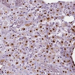 p57 Kip2 Antibody, Novus Biologicals 0.1mL; Unlabeled:Antibodies, Polyclonal