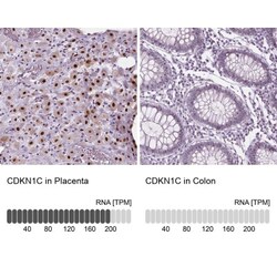 p57 Kip2 Antibody, Novus Biologicals 0.1mL; Unlabeled:Antibodies, Polyclonal