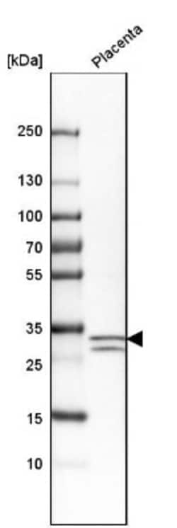 p57 Kip2 Antibody, Novus Biologicals 0.1mL; Unlabeled:Antibodies, Polyclonal