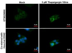p62/SQSTM1 Antibody (1478), Novus Biologicals 0.1mL; Unlabeled:Antibodies,