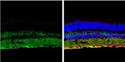 p62/SQSTM1 Antibody (1478), Novus Biologicals 0.1mL; Unlabeled:Antibodies,