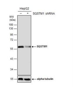 p62/SQSTM1 Antibody (1478), Novus Biologicals 0.1mL; Unlabeled:Antibodies,
