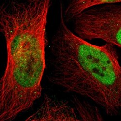 p66 alpha Antibody, Novus Biologicals:Antibodies:Primary Antibodies