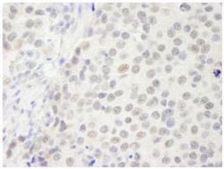 p66 beta Antibody, Novus Biologicals 0.1mL; Unlabeled:Antibodies, Polyclonal