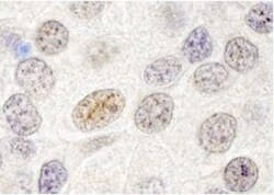 p66 beta Antibody, Novus Biologicals 0.1mL; Unlabeled:Antibodies, Polyclonal