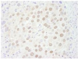 p66 beta Antibody, Novus Biologicals 0.1mL; Unlabeled:Antibodies, Polyclonal