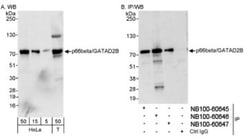 p66 beta Antibody, Novus Biologicals 0.1mL; Unlabeled:Antibodies, Polyclonal