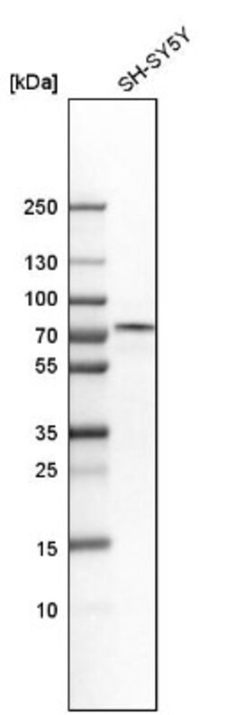 p66 beta Antibody, Novus Biologicals 25 &mu;L; Unlabeled:Antibodies, Polyclonal