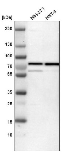 p66 beta Antibody, Novus Biologicals 25 &mu;L; Unlabeled:Antibodies, Polyclonal