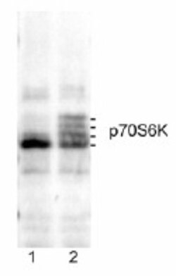 p70 S6 Kinase/S6K Antibody, Novus Biologicals 0.1mg; Unlabeled:Antibodies,