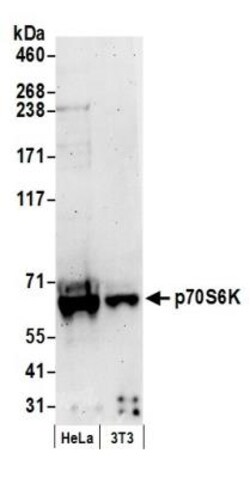 p70 S6 Kinase/S6K Antibody, Novus Biologicals 0.1mg; Unlabeled:Antibodies,
