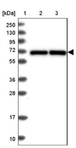 p70 S6 Kinase/S6K Antibody, Novus Biologicals 0.1mL; Unlabeled:Antibodies,