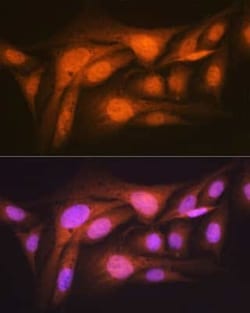 p70 S6 Kinase beta/S6K2 Rabbit anti-Human, Mouse, Rat, Clone: 5D8F5, Novus