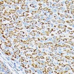 p70 S6 Kinase beta/S6K2 Rabbit anti-Human, Mouse, Rat, Clone: 5D8F5, Novus