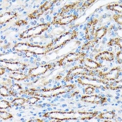 p70 S6 Kinase beta/S6K2 Rabbit anti-Human, Mouse, Rat, Clone: 5D8F5, Novus
