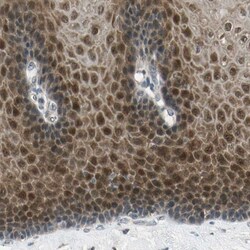 p70 S6 Kinase beta/S6K2 Antibody, Novus Biologicals 0.1mL; Unlabeled:Antibodies,