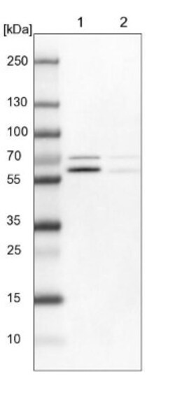 p70 S6 Kinase beta/S6K2 Antibody, Novus Biologicals 0.1mL; Unlabeled:Antibodies,
