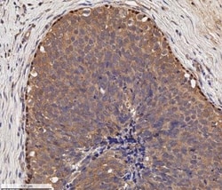 p73 Antibody (5B1288) - BSA Free, Novus Biologicals:Antibodies:Primary