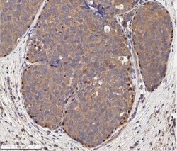 p73 Antibody (5B1288) - BSA Free, Novus Biologicals:Antibodies:Primary