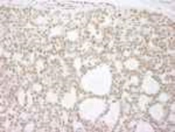 p73 Antibody, Novus Biologicals 0.1mL; Unlabeled:Antibodies, Polyclonal