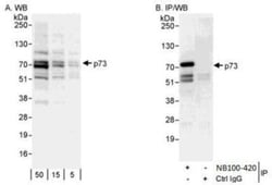 p73 Antibody, Novus Biologicals 0.1mL; Unlabeled:Antibodies, Polyclonal