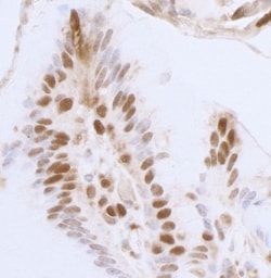 p97/VCP Antibody, Novus Biologicals 0.1mL; Unlabeled:Antibodies, Polyclonal