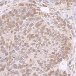 p97/VCP Antibody, Novus Biologicals 0.1mL; Unlabeled:Antibodies, Polyclonal