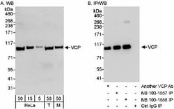 p97/VCP Antibody, Novus Biologicals 0.1mL; Unlabeled:Antibodies, Polyclonal