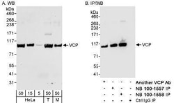 p97/VCP Antibody, Novus Biologicals 0.1mL; Unlabeled:Anticuerpos
