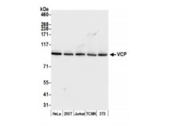p97/VCP Antibody, Novus Biologicals 0.1mL; Unlabeled:Antibodies, Polyclonal