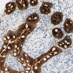 pIgR Antibody, Novus Biologicals:Antibodies:Primary Antibodies