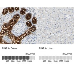 pIgR Antibody, Novus Biologicals:Antibodies:Primary Antibodies