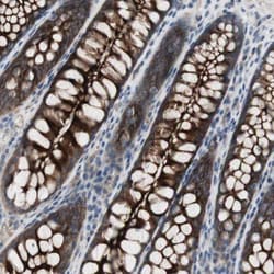 Latrophilin 1/LPHN1 Antibody, Novus Biologicals:Antibodies:Primary Antibodies