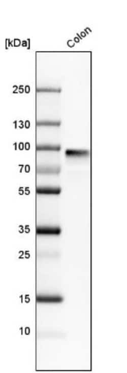pIgR Antibody, Novus Biologicals:Antibodies:Primary Antibodies