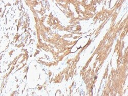 Actin (Muscle Specific) Antibody (HHF35 + MSA/953), Novus Biologicals 0.2mg;