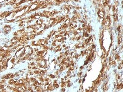 Actin (Muscle Specific) Antibody (HHF35 + MSA/953), Novus Biologicals 0.2mg;