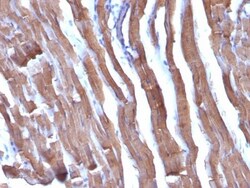 Actin (Muscle Specific) Antibody (HHF35 + MSA/953), Novus Biologicals 0.2mg;