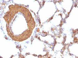 Actin (Muscle Specific) Antibody (HHF35 + MSA/953), Novus Biologicals 0.2mg;