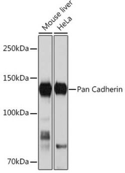 pan Cadherin Rabbit anti-Human, Mouse, Rat, Clone: 6N5P8, Novus Biologicals 20 &mu;g | Buy Online | Bio-Techne | Fisher Scientific