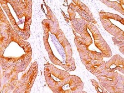Mouse anti-pan Cytokeratin, Clone: AE1 + AE3, Azide Free, Novus Biologicals