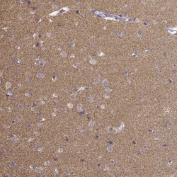 pan-Synuclein Antibody, Novus Biologicals:Antibodies:Primary Antibodies