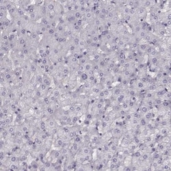 pan-Synuclein Antibody, Novus Biologicals:Antibodies:Primary Antibodies