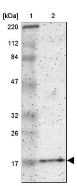 pan-Synuclein Antibody, Novus Biologicals:Antibodies:Primary Antibodies