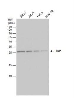 NPPB Antibody, Novus Biologicals 0.1mg; Unlabeled:Antibodies, Polyclonal