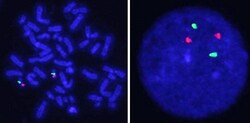 Abnova™ PPM1D/CEN17qFISH Probe