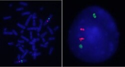 Abnova™ NRAS/CEN1q FISH Probe