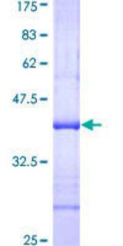 Novus Biologicals Recombinant Human NAT2 GST (N-Term) Protein 10 &mu;g | Buy Online | Novus Biologicals&trade; | Fisher Scientific