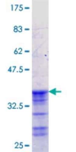 Novus Biologicals Recombinant Human ACCN2 GST (N-Term) Protein 25 &mu;g | Buy Online | Novus Biologicals&trade; | Fisher Scientific
